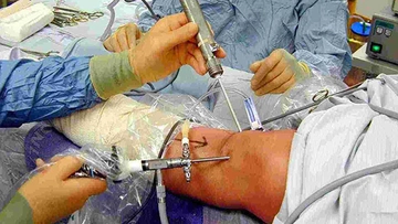 Kireçlenme Ameliyatı Riskleri ve Sonrası Kireçlenme Ameliyatı Riskleri ve Sonrası