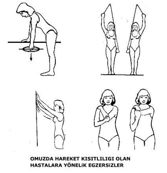 Omuz Kireçlenmesi Egzersizleri Nasıl Yapılır? Omuz Kireçlenmesi Egzersizleri Nasıl Yapılır?
